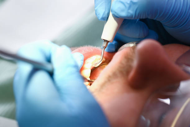 Best Broken Tooth Emergency  in Velda City, MO